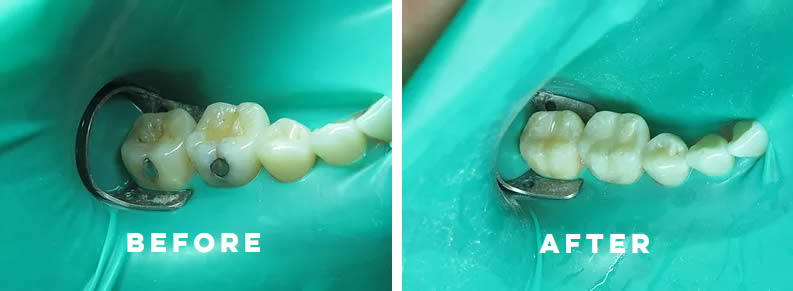 Before and after dental services